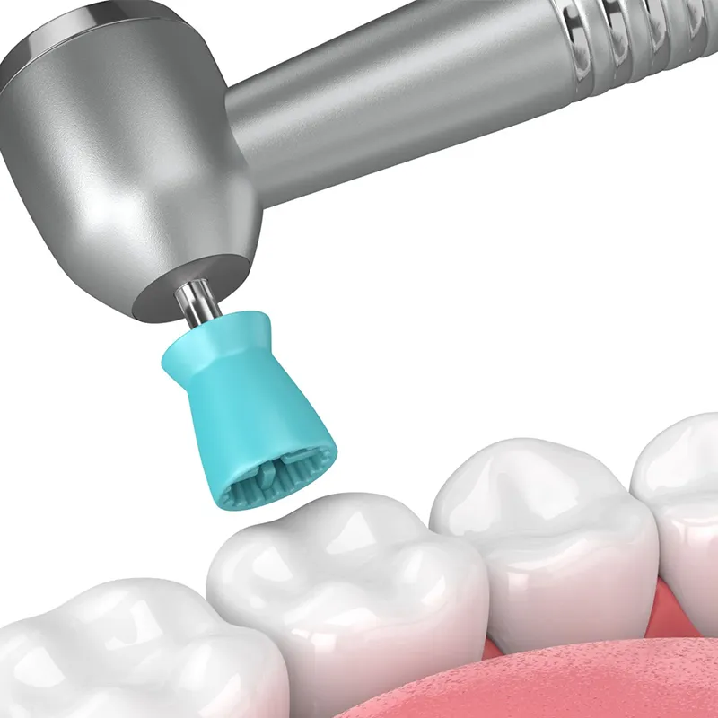 Dental scale and clean