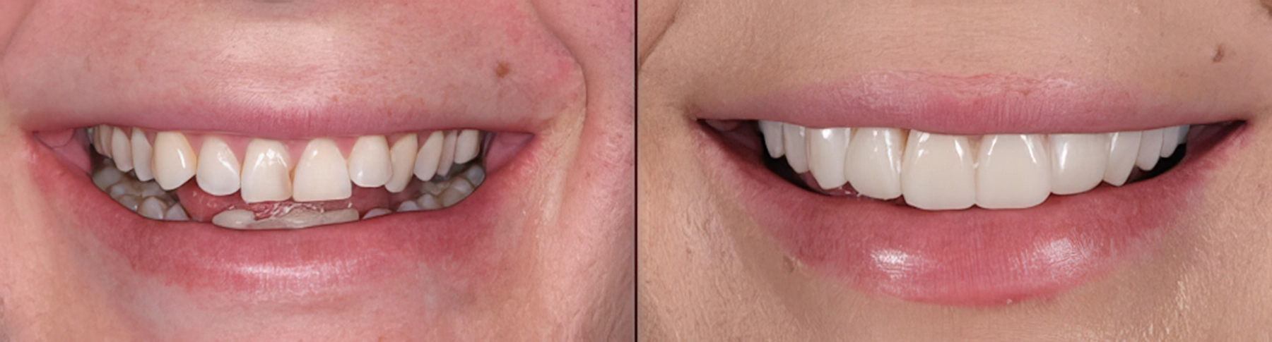 Dental works transformation Dental works transformation