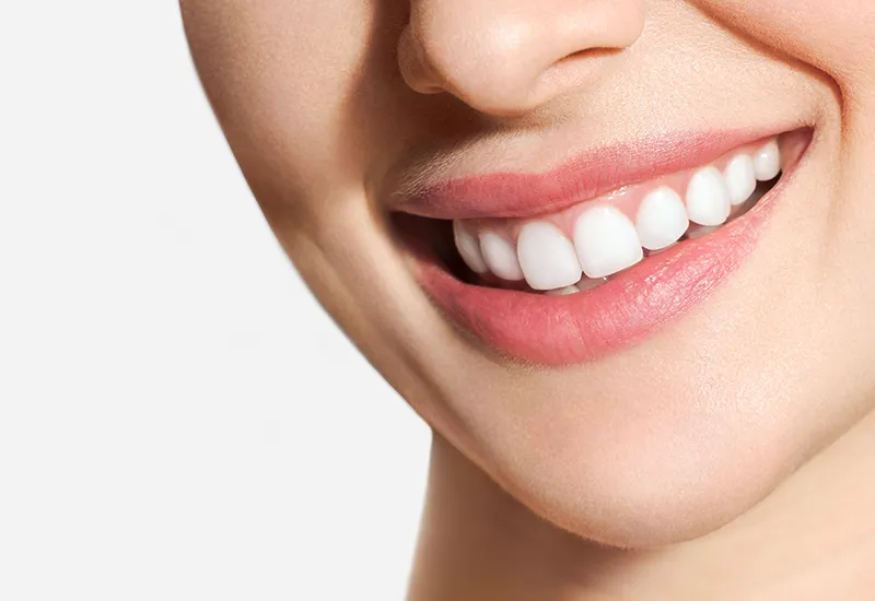Gummy Smiles Gummy Smiles