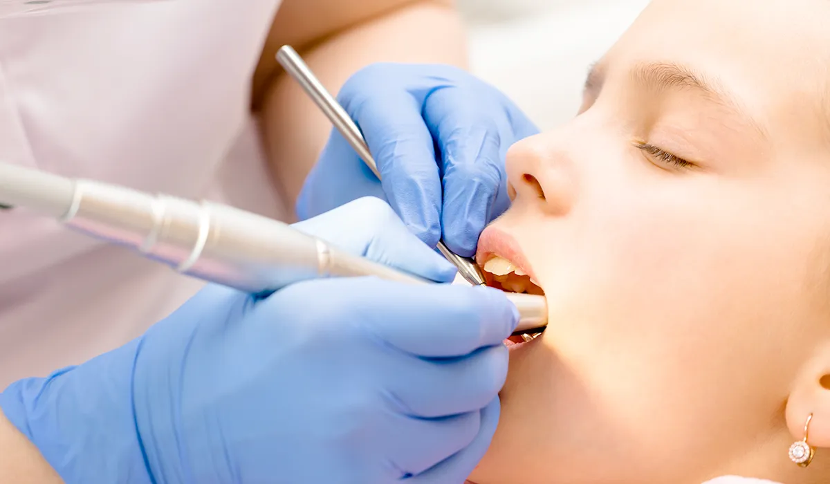 dental plaque