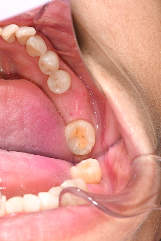 Treatment plan Treatment plan