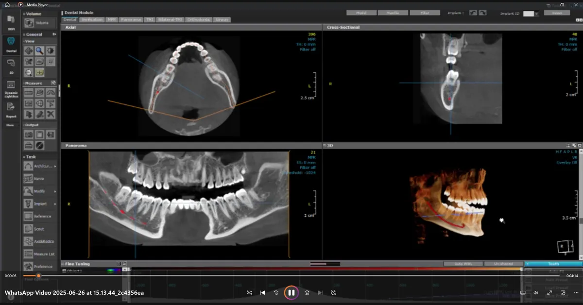 Dental Paradiso CBCT Dental Paradiso CBCT