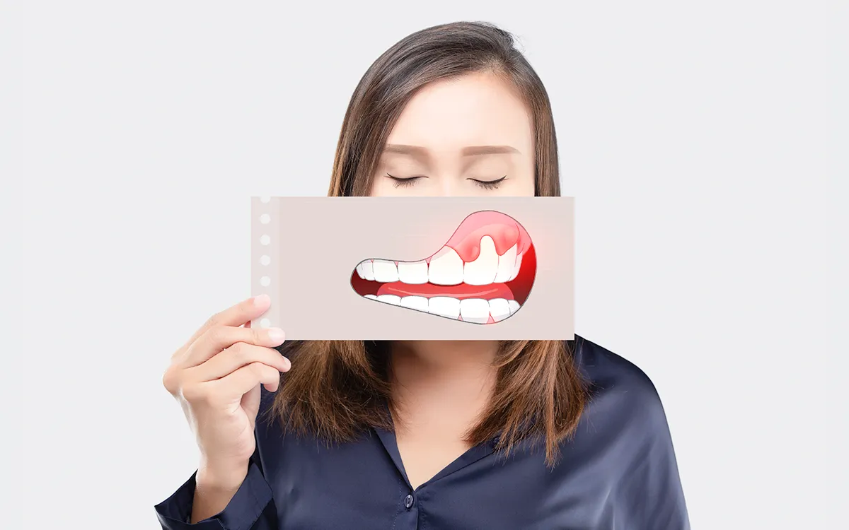 gum spots and patches