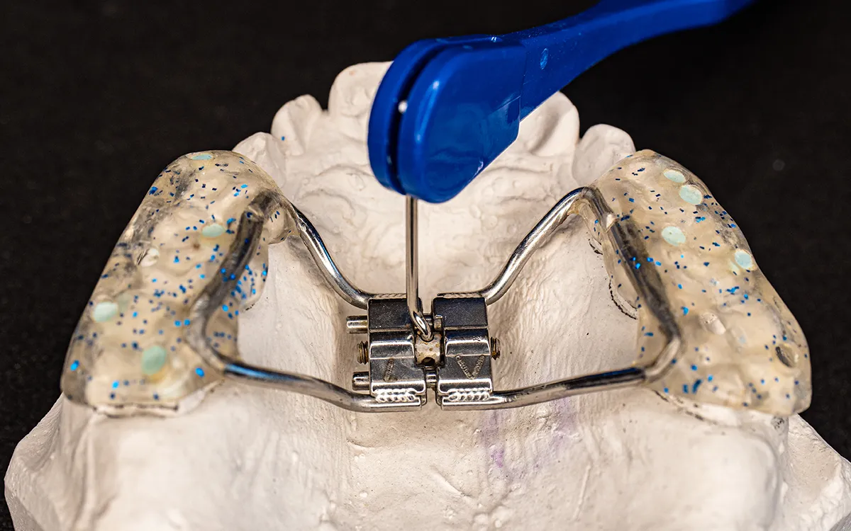 Orthodontic expansion