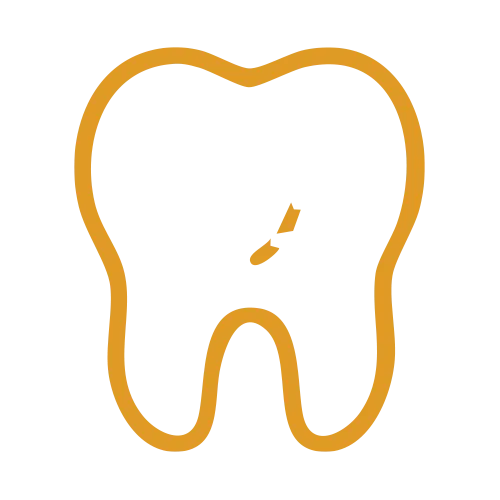 Dental Veneers