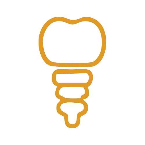 Dental implants